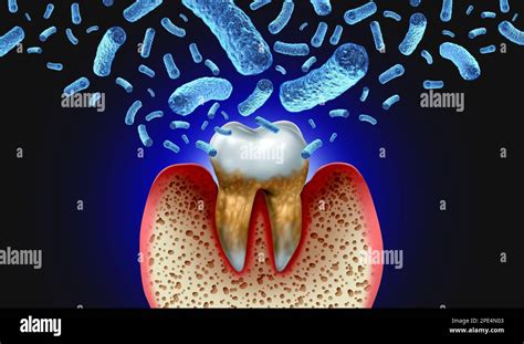The Role of Fluoride in Preventing Tooth Decay: Debunking the Myths